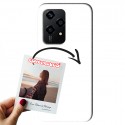 COVER MORBIDA PERSONALIZZATA HONOR 200 LITE